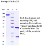SDS-PAGE Analysis of Purified Mucin 16 / CA125 Recombinant Rabbit Monoclonal Antibody (CA125/13895R). Confirmation of Purity and Integrity of Antibody.