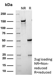 SDS-PAGE Analysis of Purified ENTPD1 antibody (clone r22A9). Confirmation of Purity and Integrity of Antibody.