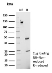 SDS-PAGE Analysis of Purified CD40 Molecule Antibody (clone r11E9). Confirmation of Purity and Integrity of Antibody.