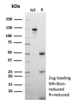 SDS-PAGE Analysis of Purified VEGI Mouse Monoclonal Antibody (VEGI/13117). Confirmation of Purity and Integrity of Antibody.