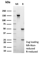 SDS-PAGE Analysis of Purified NS3/Non-structural protein 3 antibody (clone rMMM33). Confirmation of Purity and Integrity of Antibody.