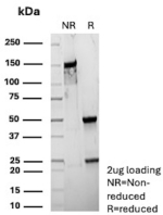 SDS-PAGE Analysis of Purified CMV-p65 Recombinant Mouse Monoclonal Antibody (r2). Confirmation of Purity and Integrity of Antibody.