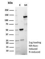 SDS-PAGE Analysis of Purified 6xHis Tag/His Epitope Tag antibody (clone 6HIS/13239R). Confirmation of Purity and Integrity of Antibody.