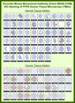 Occludin Mouse Monoclonal Antibody (MSVA-415M) tested on many normal and cancer tissues. The immunohistochemistry staining in these tissues aligns with the expression data in Human Protein Atlas. <br><br>Manual Protocol: Freshly cut sections should be used (less than 10 days between cutting and staining). Heat-induced antigen retrieval for 5 minutes in an autoclave at 121oC in pH 7.8 Target Retrieval Solution buffer. Apply the antibody at a dilution of 1:150 at 37oC for 60 minutes. Visualization of bound antibody by the EnVision Kit (Dako, Agilent) according to the manufacturer's directions.