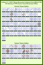 Cadherin-17 Mouse Monoclonal Antibody (MSVA-517M) tested on many normal and cancer tissues. The immunohistochemistry staining in these tissues aligns with the expression data in Human Protein Atlas. <br><br>Manual Protocol: Freshly cut sections should be used (less than 10 days between cutting and staining). Heat-induced antigen retrieval for 5 minutes in an autoclave at 121oC in pH 7.8 Target Retrieval Solution buffer. Apply the antibody at a dilution of 1:150 at 37oC for 60 minutes. Visualization of bound antibody by the EnVision Kit (Dako, Agilent) according to the manufacturer