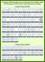 Uroplakin-3b Mouse Monoclonal Antibody (MSVA-736M) tested on many normal and cancer tissues. The immunohistochemistry staining in these tissues aligns with the expression data in Human Protein Atlas. <br><br>Manual Protocol: Freshly cut sections should be used (less than 10 days between cutting and staining). Heat-induced antigen retrieval for 5 minutes in an autoclave at 121oC in pH 7.8 Target Retrieval Solution buffer. Apply the antibody at a dilution of 1:150 at 37oC for 60 minutes. Visualization of bound antibody by the EnVision Kit (Dako, Agilent) according to the manufacturer