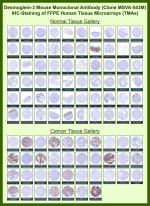 Desmoglein-3 Mouse Monoclonal Antibody (MSVA-543M) tested on many normal and cancer tissues. The immunohistochemistry staining in these tissues aligns with the expression data in Human Protein Atlas. <br><br>Manual Protocol: Freshly cut sections should be used (less than 10 days between cutting and staining). Heat-induced antigen retrieval for 5 minutes in an autoclave at 121oC in pH 7.8 Target Retrieval Solution buffer. Apply the antibody at a dilution of 1:150 at 37oC for 60 minutes. Visualization of bound antibody by the EnVision Kit (Dako, Agilent) according to the manufacturer