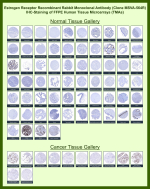 Immunohistochemistry tissue microarray analysis of Estrogen receptor alpha expression. This recombinant Estrogen receptor alpha/ER alpha antibody (clone MSVA-564R) was evaluated by immunohistochemistry on formalin-fixed, paraffin-embedded human tissue microarrays covering a broad range of normal and cancer tissues. Staining demonstrates predominantly nuclear immunoreactivity in hormone-responsive epithelial tissues consistent with known Estrogen receptor alpha / ER alpha / ESR1 expression patterns, with limited staining in tissues lacking estrogen signaling activity. Cancer tissues show variable nuclear positivity depending on tumor type and hormone responsiveness. Overall staining distribution and relative expression patterns are concordant with publicly available expression data reported by the Human Protein Atlas, supporting the biological relevance of the observed immunoreactivity.