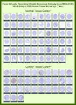Coagulation factor XIII A chain Rabbit Recombinant Monoclonal Antibody (MSVA-813R) tested on many normal and cancer tissues. The immunohistochemistry staining in these tissues aligns with the expression data in Human Protein Atlas. <br><br>Manual Protocol: Freshly cut sections should be used (less than 10 days between cutting and staining). Heat-induced antigen retrieval for 5 minutes in an autoclave at 121oC in pH 7.8 Target Retrieval Solution buffer. Apply the antibody at a dilution of 1:150 at 37oC for 60 minutes. Visualization of bound antibody by the EnVision Kit (Dako, Agilent) according to the manufacturer