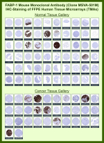 Fatty acid-binding protein, liver Mouse Monoclonal Antibody (MSVA-501M) tested on many normal and cancer tissues. The immunohistochemistry staining in these tissues aligns with the expression data in Human Protein Atlas. <br><br>Manual Protocol: Freshly cut sections should be used (less than 10 days between cutting and staining). Heat-induced antigen retrieval for 5 minutes in an autoclave at 121oC in pH 7.8 Target Retrieval Solution buffer. Apply the antibody at a dilution of 1:150 at 37oC for 60 minutes. Visualization of bound antibody by the EnVision Kit (Dako, Agilent) according to the manufacturer's directions.