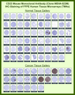 Low affinity immunoglobulin epsilon Fc receptor Mouse Monoclonal Antibody (MSVA-023M) tested on many normal and cancer tissues. The immunohistochemistry staining in these tissues aligns with the expression data in Human Protein Atlas. <br><br>Manual Protocol: Freshly cut sections should be used (less than 10 days between cutting and staining). Heat-induced antigen retrieval for 5 minutes in an autoclave at 121oC in pH 7.8 Target Retrieval Solution buffer. Apply the antibody at a dilution of 1:150 at 37oC for 60 minutes. Visualization of bound antibody by the EnVision Kit (Dako, Agilent) according to the manufacturer's directions.