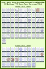 Glutamate decarboxylase 2 Mouse Monoclonal Antibody (MSVA-602M) tested on many normal and cancer tissues. The immunohistochemistry staining in these tissues aligns with the expression data in Human Protein Atlas. <br><br>Manual Protocol: Freshly cut sections should be used (less than 10 days between cutting and staining). Heat-induced antigen retrieval for 5 minutes in an autoclave at 121oC in pH 7.8 Target Retrieval Solution buffer. Apply the antibody at a dilution of 1:150 at 37oC for 60 minutes. Visualization of bound antibody by the EnVision Kit (Dako, Agilent) according to the manufacturer