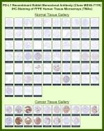 Programmed cell death 1 ligand 1 Rabbit Recombinant Monoclonal Antibody (MSVA-711R) tested on many normal and cancer tissues. The immunohistochemistry staining in these tissues aligns with the expression data in Human Protein Atlas. <br><br>Manual Protocol: Freshly cut sections should be used (less than 10 days between cutting and staining). Heat-induced antigen retrieval for 5 minutes in an autoclave at 121oC in pH 7.8 Target Retrieval Solution buffer. Apply the antibody at a dilution of 1:150 at 37oC for 60 minutes. Visualization of bound antibody by the EnVision Kit (Dako, Agilent) according to the manufacturer's directions.