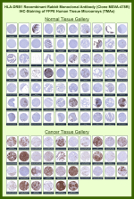 HLA class II histocompatibility antigen, DRB1 beta chain Rabbit Recombinant Monoclonal Antibody (MSVA-478R) tested on many normal and cancer tissues. The immunohistochemistry staining in these tissues aligns with the expression data in Human Protein Atlas. <br><br>Manual Protocol: Freshly cut sections should be used (less than 10 days between cutting and staining). Heat-induced antigen retrieval for 5 minutes in an autoclave at 121oC in pH 7.8 Target Retrieval Solution buffer. Apply the antibody at a dilution of 1:150 at 37oC for 60 minutes. Visualization of bound antibody by the EnVision Kit (Dako, Agilent) according to the manufacturer's directions.
