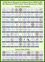 Stimulator of interferon genes protein Mouse Monoclonal Antibody (MSVA-515M) tested on many normal and cancer tissues. The immunohistochemistry staining in these tissues aligns with the expression data in Human Protein Atlas. <br><br>Manual Protocol: Freshly cut sections should be used (less than 10 days between cutting and staining). Heat-induced antigen retrieval for 5 minutes in an autoclave at 121oC in pH 7.8 Target Retrieval Solution buffer. Apply the antibody at a dilution of 1:150 at 37oC for 60 minutes. Visualization of bound antibody by the EnVision Kit (Dako, Agilent) according to the manufacturer