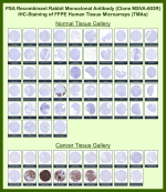 Prostate-specific antigen Rabbit Recombinant Monoclonal Antibody (MSVA-603R) tested on many normal and cancer tissues. The immunohistochemistry staining in these tissues aligns with the expression data in Human Protein Atlas. <br><br>Manual Protocol: Freshly cut sections should be used (less than 10 days between cutting and staining). Heat-induced antigen retrieval for 5 minutes in an autoclave at 121oC in pH 7.8 Target Retrieval Solution buffer. Apply the antibody at a dilution of 1:150 at 37oC for 60 minutes. Visualization of bound antibody by the EnVision Kit (Dako, Agilent) according to the manufacturer's directions.