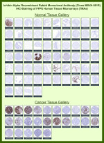 Inhibin alpha chain Rabbit Recombinant Monoclonal Antibody (MSVA-561R) tested on many normal and cancer tissues. The immunohistochemistry staining in these tissues aligns with the expression data in Human Protein Atlas. <br><br>Manual Protocol: Freshly cut sections should be used (less than 10 days between cutting and staining). Heat-induced antigen retrieval for 5 minutes in an autoclave at 121oC in pH 7.8 Target Retrieval Solution buffer. Apply the antibody at a dilution of 1:150 at 37oC for 60 minutes. Visualization of bound antibody by the EnVision Kit (Dako, Agilent) according to the manufacturer