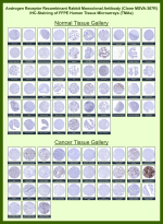 Androgen receptor Rabbit Recombinant Monoclonal Antibody (MSVA-367R) tested on many normal and cancer tissues. The immunohistochemistry staining in these tissues aligns with the expression data in Human Protein Atlas. <br><br>Manual Protocol: Freshly cut sections should be used (less than 10 days between cutting and staining). Heat-induced antigen retrieval for 5 minutes in an autoclave at 121oC in pH 7.8 Target Retrieval Solution buffer. Apply the antibody at a dilution of 1:150 at 37oC for 60 minutes. Visualization of bound antibody by the EnVision Kit (Dako, Agilent) according to the manufacturer's directions.