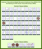 Arginase-1 Rabbit Recombinant Monoclonal Antibody (MSVA-511R) tested on many normal and cancer tissues. The immunohistochemistry staining in these tissues aligns with the expression data in Human Protein Atlas. <br><br>Manual Protocol: Freshly cut sections should be used (less than 10 days between cutting and staining). Heat-induced antigen retrieval for 5 minutes in an autoclave at 121oC in pH 7.8 Target Retrieval Solution buffer. Apply the antibody at a dilution of 1:150 at 37oC for 60 minutes. Visualization of bound antibody by the EnVision Kit (Dako, Agilent) according to the manufacturer's directions.