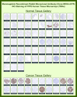 Mammaglobin-A Rabbit Recombinant Monoclonal Antibody (MSVA-457R) tested on many normal and cancer tissues. The immunohistochemistry staining in these tissues aligns with the expression data in Human Protein Atlas. <br><br>Manual Protocol: Freshly cut sections should be used (less than 10 days between cutting and staining). Heat-induced antigen retrieval for 5 minutes in an autoclave at 121oC in pH 7.8 Target Retrieval Solution buffer. Apply the antibody at a dilution of 1:150 at 37oC for 60 minutes. Visualization of bound antibody by the EnVision Kit (Dako, Agilent) according to the manufacturer
