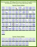 Myeloperoxidase Antibody for IHC / MPO Immunohistochemistry Antibody (clone MSVA-692M). Immunohistochemistry analysis of FFPE human tissue microarrays using Myeloperoxidase antibody for IHC (clone MSVA-692M). Strong cytoplasmic brown staining is observed in granulocytic cells within bone marrow and scattered inflammatory cells in tissues such as tonsil and spleen, consistent with the known localization of Myeloperoxidase / MPO in neutrophil lineage cells. Most epithelial and stromal tissues show minimal staining. The observed immunohistochemistry staining patterns across normal and cancer tissues align with MPO expression profiles reported in the Human Protein Atlas.