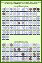 Neural cell adhesion molecule 1 Rabbit Recombinant Monoclonal Antibody (MSVA-056R) tested on many normal and cancer tissues. The immunohistochemistry staining in these tissues aligns with the expression data in Human Protein Atlas. <br><br>Manual Protocol: Freshly cut sections should be used (less than 10 days between cutting and staining). Heat-induced antigen retrieval for 5 minutes in an autoclave at 121oC in pH 7.8 Target Retrieval Solution buffer. Apply the antibody at a dilution of 1:150 at 37oC for 60 minutes. Visualization of bound antibody by the EnVision Kit (Dako, Agilent) according to the manufacturer's directions.