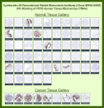 Keratin, type I cytoskeletal 20 Rabbit Recombinant Monoclonal Antibody (MSVA-620R) tested on many normal and cancer tissues. The immunohistochemistry staining in these tissues aligns with the expression data in Human Protein Atlas. <br><br>Manual Protocol: Freshly cut sections should be used (less than 10 days between cutting and staining). Heat-induced antigen retrieval for 5 minutes in an autoclave at 121oC in pH 7.8 Target Retrieval Solution buffer. Apply the antibody at a dilution of 1:150 at 37oC for 60 minutes. Visualization of bound antibody by the EnVision Kit (Dako, Agilent) according to the manufacturer's directions.