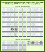 Prostatic acid phosphatase Mouse Recombinant Monoclonal Antibody (MSVA-452M) tested on many normal and cancer tissues. The immunohistochemistry staining in these tissues aligns with the expression data in Human Protein Atlas. <br><br>Manual Protocol: Freshly cut sections should be used (less than 10 days between cutting and staining). Heat-induced antigen retrieval for 5 minutes in an autoclave at 121oC in pH 7.8 Target Retrieval Solution buffer. Apply the antibody at a dilution of 1:150 at 37oC for 60 minutes. Visualization of bound antibody by the EnVision Kit (Dako, Agilent) according to the manufacturer