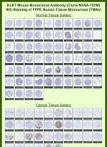 Kallikrein-7 Mouse Monoclonal Antibody (MSVA-707M) tested on many normal and cancer tissues. The immunohistochemistry staining in these tissues aligns with the expression data in Human Protein Atlas. <br><br>Manual Protocol: Freshly cut sections should be used (less than 10 days between cutting and staining). Heat-induced antigen retrieval for 5 minutes in an autoclave at 121oC in pH 7.8 Target Retrieval Solution buffer. Apply the antibody at a dilution of 1:150 at 37oC for 60 minutes. Visualization of bound antibody by the EnVision Kit (Dako, Agilent) according to the manufacturer