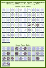 Solute carrier family 2, facilitated glucose transporter member 1 Rabbit Recombinant Monoclonal Antibody (MSVA-401R) tested on many normal and cancer tissues. The immunohistochemistry staining in these tissues aligns with the expression data in Human Protein Atlas. <br><br>Manual Protocol: Freshly cut sections should be used (less than 10 days between cutting and staining). Heat-induced antigen retrieval for 5 minutes in an autoclave at 121oC in pH 7.8 Target Retrieval Solution buffer. Apply the antibody at a dilution of 1:150 at 37oC for 60 minutes. Visualization of bound antibody by the EnVision Kit (Dako, Agilent) according to the manufacturer