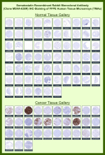 Rabbit Recombinant Monoclonal Antibody (MSVA-638R) tested on many normal and cancer tissues. The immunohistochemistry staining in these tissues aligns with the expression data in Human Protein Atlas. <br><br>Manual Protocol: Freshly cut sections should be used (less than 10 days between cutting and staining). Heat-induced antigen retrieval for 5 minutes in an autoclave at 121oC in pH 7.8 Target Retrieval Solution buffer. Apply the antibody at a dilution of 1:150 at 37oC for 60 minutes. Visualization of bound antibody by the EnVision Kit (Dako, Agilent) according to the manufacturer's directions.