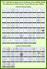 Trefoil factor 1 Mouse Monoclonal Antibody (MSVA-482M) tested on many normal and cancer tissues. The immunohistochemistry staining in these tissues aligns with the expression data in Human Protein Atlas. <br><br>Manual Protocol: Freshly cut sections should be used (less than 10 days between cutting and staining). Heat-induced antigen retrieval for 5 minutes in an autoclave at 121oC in pH 7.8 Target Retrieval Solution buffer. Apply the antibody at a dilution of 1:150 at 37oC for 60 minutes. Visualization of bound antibody by the EnVision Kit (Dako, Agilent) according to the manufacturer's directions.