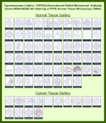 DNA topoisomerase 2-alpha Rabbit Recombinant Monoclonal Antibody (MSVA-802R) tested on many normal and cancer tissues. The immunohistochemistry staining in these tissues aligns with the expression data in Human Protein Atlas. <br><br>Manual Protocol: Freshly cut sections should be used (less than 10 days between cutting and staining). Heat-induced antigen retrieval for 5 minutes in an autoclave at 121oC in pH 7.8 Target Retrieval Solution buffer. Apply the antibody at a dilution of 1:150 at 37oC for 60 minutes. Visualization of bound antibody by the EnVision Kit (Dako, Agilent) according to the manufacturer's directions.