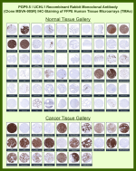 Ubiquitin carboxyl-terminal hydrolase isozyme L1 Rabbit Recombinant Monoclonal Antibody (MSVA-905R) tested on many normal and cancer tissues. The immunohistochemistry staining in these tissues aligns with the expression data in Human Protein Atlas. <br><br>Manual Protocol: Freshly cut sections should be used (less than 10 days between cutting and staining). Heat-induced antigen retrieval for 5 minutes in an autoclave at 121oC in pH 7.8 Target Retrieval Solution buffer. Apply the antibody at a dilution of 1:150 at 37oC for 60 minutes. Visualization of bound antibody by the EnVision Kit (Dako, Agilent) according to the manufacturer's directions.