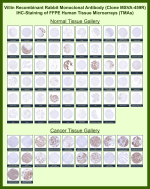 Villin-1 Rabbit Recombinant Monoclonal Antibody (MSVA-459R) tested on many normal and cancer tissues. The immunohistochemistry staining in these tissues aligns with the expression data in Human Protein Atlas. <br><br>Manual Protocol: Freshly cut sections should be used (less than 10 days between cutting and staining). Heat-induced antigen retrieval for 5 minutes in an autoclave at 121oC in pH 7.8 Target Retrieval Solution buffer. Apply the antibody at a dilution of 1:150 at 37oC for 60 minutes. Visualization of bound antibody by the EnVision Kit (Dako, Agilent) according to the manufacturer's directions.