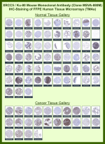 X-ray repair cross-complementing protein 5 Mouse Monoclonal Antibody (MSVA-880M) tested on many normal and cancer tissues. The immunohistochemistry staining in these tissues aligns with the expression data in Human Protein Atlas. <br><br>Manual Protocol: Freshly cut sections should be used (less than 10 days between cutting and staining). Heat-induced antigen retrieval for 5 minutes in an autoclave at 121oC in pH 7.8 Target Retrieval Solution buffer. Apply the antibody at a dilution of 1:150 at 37oC for 60 minutes. Visualization of bound antibody by the EnVision Kit (Dako, Agilent) according to the manufacturer