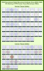 Paired box protein Pax-8 Rabbit Recombinant Monoclonal Antibody (MSVA-708R) tested on many normal and cancer tissues. The immunohistochemistry staining in these tissues aligns with the expression data in Human Protein Atlas. <br><br>Manual Protocol: Freshly cut sections should be used (less than 10 days between cutting and staining). Heat-induced antigen retrieval for 5 minutes in an autoclave at 121oC in pH 7.8 Target Retrieval Solution buffer. Apply the antibody at a dilution of 1:150 at 37oC for 60 minutes. Visualization of bound antibody by the EnVision Kit (Dako, Agilent) according to the manufacturer's directions.