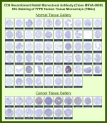 T-cell surface glycoprotein CD8 alpha chain Rabbit Recombinant Monoclonal Antibody (MSVA-008R) tested on many normal and cancer tissues. The immunohistochemistry staining in these tissues aligns with the expression data in Human Protein Atlas. <br><br>Manual Protocol: Freshly cut sections should be used (less than 10 days between cutting and staining). Heat-induced antigen retrieval for 5 minutes in an autoclave at 121oC in pH 7.8 Target Retrieval Solution buffer. Apply the antibody at a dilution of 1:150 at 37oC for 60 minutes. Visualization of bound antibody by the EnVision Kit (Dako, Agilent) according to the manufacturer's directions.