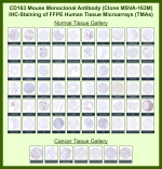 Major vault protein Mouse Monoclonal Antibody (MSVA-163M) tested on many normal and cancer tissues. The immunohistochemistry staining in these tissues aligns with the expression data in Human Protein Atlas. <br><br>Manual Protocol: Freshly cut sections should be used (less than 10 days between cutting and staining). Heat-induced antigen retrieval for 5 minutes in an autoclave at 121oC in pH 7.8 Target Retrieval Solution buffer. Apply the antibody at a dilution of 1:150 at 37oC for 60 minutes. Visualization of bound antibody by the EnVision Kit (Dako, Agilent) according to the manufacturer