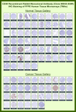 CD38 Antibody for IHC. Immunohistochemistry analysis of CD38 / plasma cell marker expression in FFPE human tissue microarrays (TMAs) using clone MSVA-038R. Strong membranous and cytoplasmic HRP-DAB brown staining highlights plasma cells within lymphoid tissues including tonsil, lymph node, and spleen, with clear identification of immune cell-rich regions. Across a wide range of normal tissues, staining is largely restricted to scattered immune cells with minimal background in epithelial and stromal compartments. In cancer tissue arrays, CD38-positive tumor-infiltrating immune cells are observed with variable density, while most tumor cells remain negative. Heat-induced epitope retrieval was performed in pH 9 Tris-EDTA buffer for 20 minutes followed by cooling prior to antibody incubation.