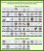 Keratin, type II cytoskeletal 1b Rabbit Recombinant Monoclonal Antibody (MSVA-000R) tested on many normal and cancer tissues. The immunohistochemistry staining in these tissues aligns with the expression data in Human Protein Atlas. <br><br>Manual Protocol: Freshly cut sections should be used (less than 10 days between cutting and staining). Heat-induced antigen retrieval for 5 minutes in an autoclave at 121oC in pH 7.8 Target Retrieval Solution buffer. Apply the antibody at a dilution of 1:150 at 37oC for 60 minutes. Visualization of bound antibody by the EnVision Kit (Dako, Agilent) according to the manufacturer's directions.