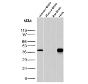 Western blot analysis of Folate receptor alpha expression in tissue and cell lysates. Lysates from human brain, mouse brain, rat brain, and human HeLa cells were analyzed by western blot using recombinant Folate receptor 1 antibody (clone FOLR1/12903R). A single immunoreactive band is detected in human brain and HeLa lysates, while little to no signal is observed in mouse and rat brain samples. Although the predicted molecular weight of Folate receptor alpha is approximately 30 kDa based on sequence analysis, the protein is extensively glycosylated, resulting in a higher apparent molecular weight on SDS-PAGE.