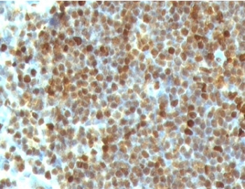 Formalin-fixed, paraffin-embedded human tonsil stained with PCNA antibody (clone PM441-1). FFPE testing requires sections to be boiled in pH 9 10mM Tris with 1mM EDTA for 10-20 minutes, followed by cooling at RT for 20 minutes, prior to staining.~