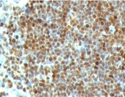 Formalin-fixed, paraffin-embedded human tonsil stained with PCNA antibody (clone PM441-1). FFPE testing requires sections to be boiled in pH 9 10mM Tris with 1mM EDTA for 10-20 minutes, followed by cooling at RT for 20 minutes, prior to staining.