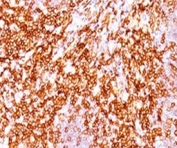 IHC testing of FFPE human tonsil and CD68 antibody (clone LAM34-1). FFPE testing requires sections to be boiled in pH 9 10mM Tris with 1mM EDTA for 10-20 minutes, followed by cooling at RT for 20 minutes, prior to staining.