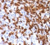 Formalin-fixed, paraffin-embedded human tonsil stained with CD44 antibody (clone HCM15-1). FFPE testing requires sections to be boiled in pH6 10mM citrate buffer for 10-20 minutes, followed by cooling at RT for 20 minutes, prior to staining.