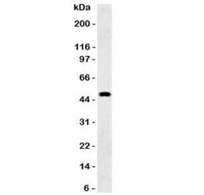 Western blot testing of human brain and GFAP antibody (clone GFA12-3). Predicted molecular weight ~50 kDa.~