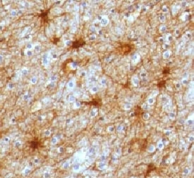 IHC testing of FFPE human brain and GFAP antibody (clone GFA12-3). FFPE testing requires sections to be boiled in pH 9 10mM Tris