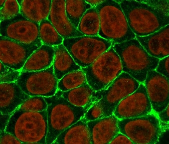 Immunofluorescent staining of human MCF7 cells with EpCAM antibody (clone EPM17-1, green) and Reddot nuclear stain (red).