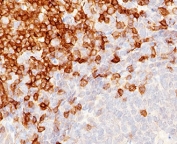 IHC testing of FFPE human tonsil stained with CD5 antibody (clone CLDA5-1). Staining of formalin-fixed tissues requires boiling tissue sections in pH 9 10mM Tris with 1mM EDTA for 10-20 min followed by cooling at RT for 20 min.